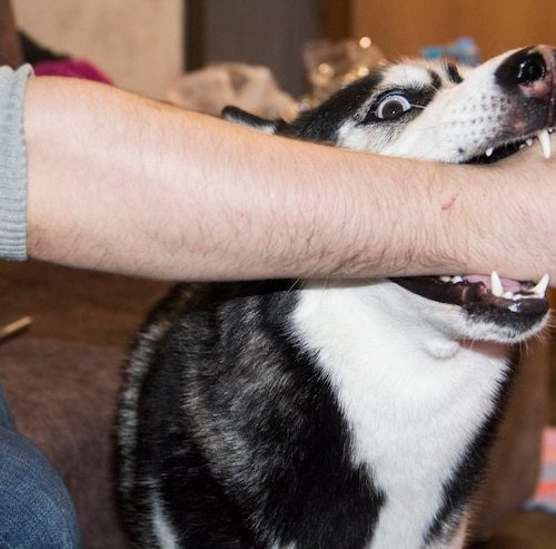 dog-bite